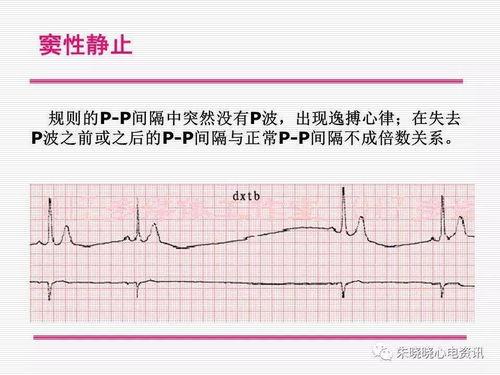 上海心电图视频吃瓜  第1张
