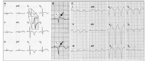上海心电图视频吃瓜  第2张