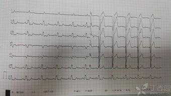 上海心电图视频吃瓜  第3张